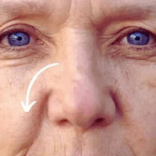 Damaged Complexion